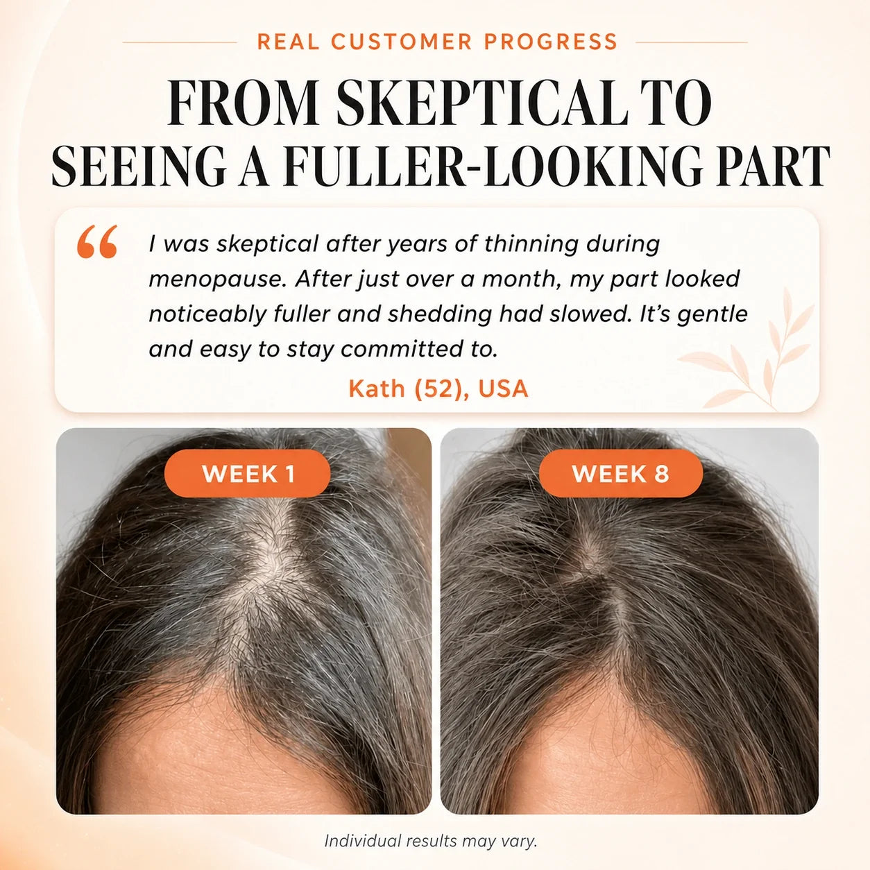 Korea's #1 Hair Growth Serum Veyla