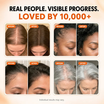 Korea's #1 Hair Growth Serum Veyla