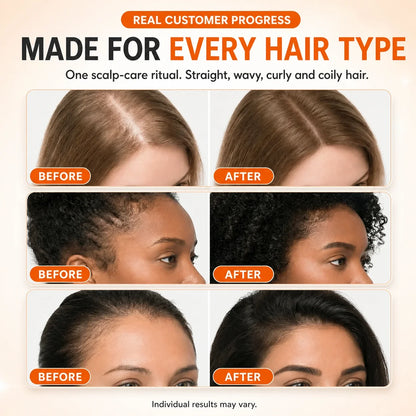 Korea's #1 Hair Growth Serum Veyla
