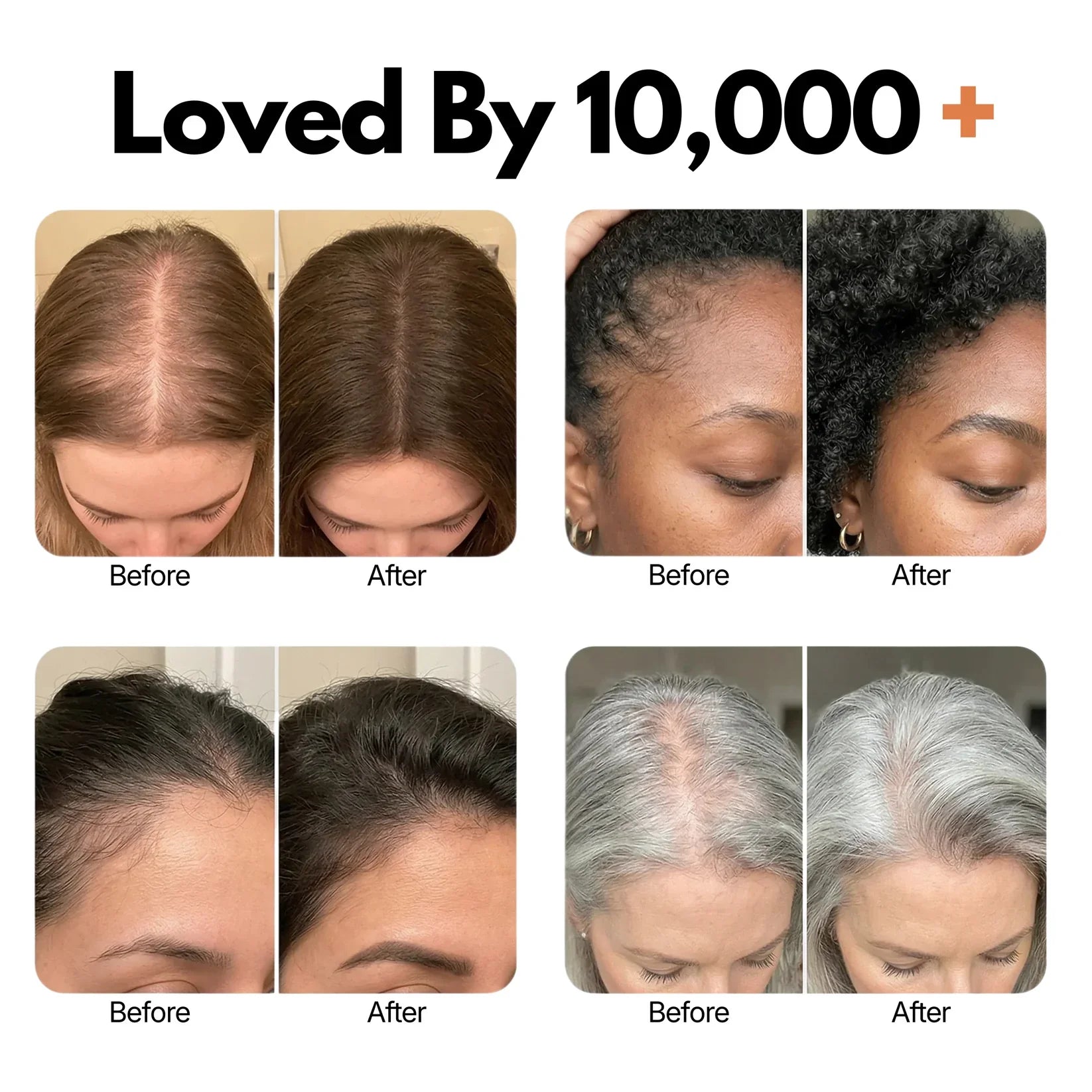 Veyla™ Hair Growth Serum Veyla