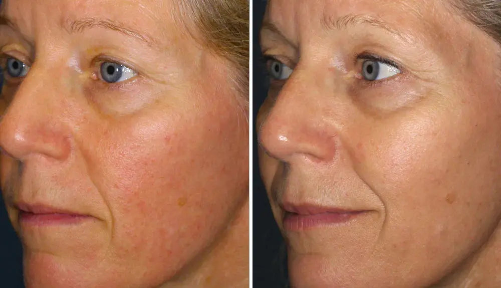 GLOWRIE SÉRUM NA ZAČERVENÁNÍ GLOWRIE