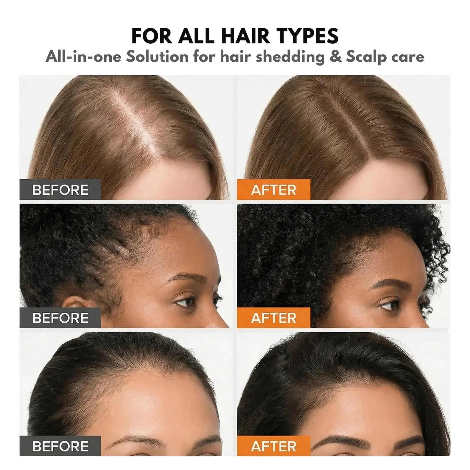 Veyla™ Hair Growth Serum Veyla