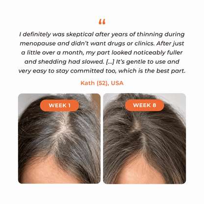 Veyla™ Hair Growth Serum Veyla